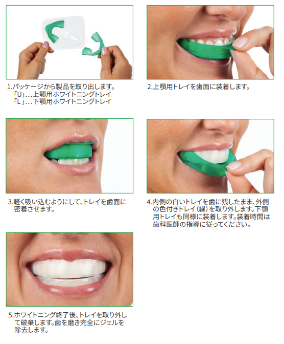 診療項目│かみ合わせ治療、審美歯科、咀嚼・発語解析検査、歯科口腔